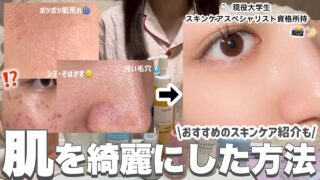【垢抜けたい人必見‼️】美容オタクが肌を綺麗にするためにしたこと📝スキンケアスペシャリストが解説🔍🗣️ #スキンケア#毛穴ケア#ニキビケア#美容#垢抜け