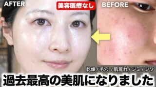 【最新スキンケア】美容医療なしで圧倒的美肌になったスキンケアルーティン全部紹介！【乾燥/毛穴/肌荒れ/シミ】