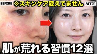 NG美容❌どんな美容液も無駄になるダメ習慣12選【毛穴/肌荒れ/ニキビ/乾燥/老化】