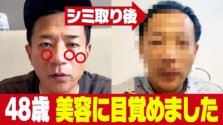 ナイツ塙48歳、初めての美容施術