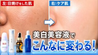 シミを作らせない美白美容液はコレです