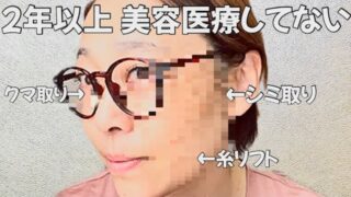 「シミ取り・クマ取り・糸リフト」美容医療を2年以上受けてない現在の肌事情〜過去治療の名前・値段も公開